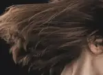 Перхоть