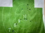 Как возникает и развивается шок?