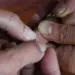 556676
